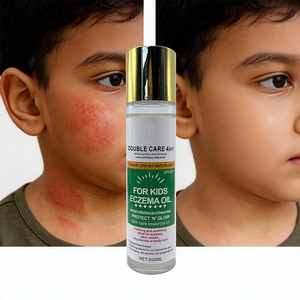 Aceite para <span class=keywords><strong>Eczema</strong></span> Infantil, Extracto Natural de Plantas, Aceite de Oliva, Vitamina E, Hidratante, Calmante, Suaviza la Textura Irregular de la Piel, Venta al por Mayor - Product Image 1