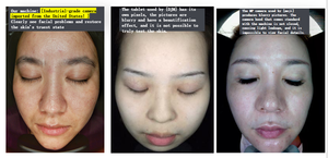 Stylo analyseur de peau Faling AI pour l'hydratation! Détecteur de lumière bleue AISIA 9 Spectres 19 Dimensions pour désinfection, 16 langues, de bureau - Product Image 6