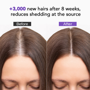Suero Capilar Profesional a Base de Hierbas para Mujeres, Contra la Caída del <span class=keywords><strong>Cabello</strong></span>, Tratamiento para el Cuidado del Cuero Cabelludo, de Rápida Absorción, con Romero y Ginseng, Venta al Por Mayor - Product Image 4