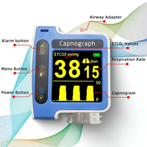 <span class=keywords><strong>Monitor</strong></span> Kapnograf ETCO2 DERRY Small Smart Real Time untuk Klinik Hewan, Rumah Sakit Hewan, ICU, Instrumen Veteriner Darurat - Product Image 2