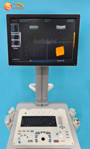 Ecógrafo de Carro SUN-907B de Alta Resolución con Doppler Color 3D 4D PW CW para Uso Hospitalario - Product Image 5