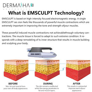 더마샤 휴대용 자석 근육 지방 연소 슬리밍 마사지기 EMS 기계 바디 조형 기계 - Product Image 6