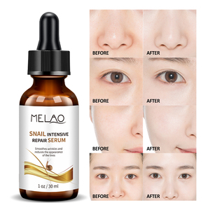 Siero per lumaca per riparazione viso antirughe siero sbiancante con estratto di mucina di lumaca 80% 30ml di cura della pelle - Product Image 2