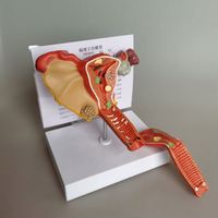Modèle pathologique KyrenMed des organes génitaux féminins Modèle de reproduction gynécologique de pathologie de l'utérus et des ovaires humains