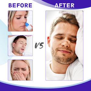 Bande nasale personnalisée de marque privée Patch nasal Bande nasale respiratoire pour respirer le sommeil améliore facilement la respiration pendant le sommeil - Product Image 3
