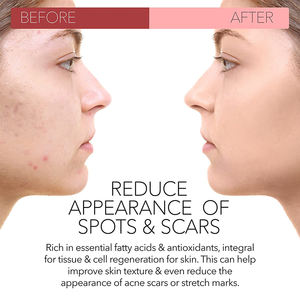 Suero <span class=keywords><strong>de</strong></span> aceite esencial para el cuidado del cuerpo, aceite esencial <span class=keywords><strong>de</strong></span> palisandro orgánico puro vegano libre <span class=keywords><strong>de</strong></span> crueldad, prensado en frío a granel para el cabello <span class=keywords><strong>de</strong></span> <span class=keywords><strong>la</strong></span> cara, venta al por mayor - Product Image 3