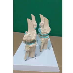 Fabrieks Menselijk Skelet Anatomisch Bot Leermodel 4-Stage Zieke Kniegewrichtsmodel - Product Image 5