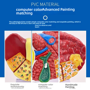 Modèle de foie en plastique PVC coloré Caractéristiques pathologiques cliniques communes Aide à la communication pour les médecins en hépatologie Gastroentérologie - Product Image 3