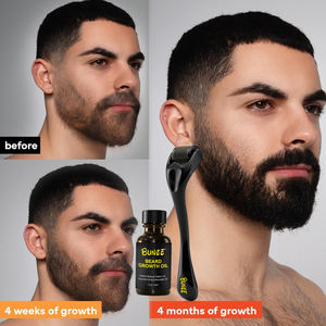 Neuestes Design Männer Frauen 0,5mm 1,0mm Haar Bart Nachwachsen Falten Narben entfernung Hautpflege 540 Haut Derma Massage Roller - Product Image 6