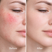 Crème Hydratante Quotidienne 3H à la Niacinamide, Céramide et Centella Asiatica pour le Visage – Réduit les Rougeurs et Restaure la Santé Cutanée