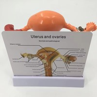 Spécialisé dans la production de modèles anatomiques pathologiques en plastique pour l'enseignement de l'utérus, des ovaires et du vagin