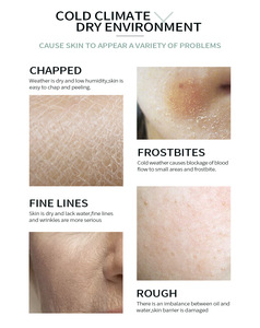 All'ingrosso laikou crema <span class=keywords><strong>viso</strong></span> all'avocado idratante <span class=keywords><strong>per</strong></span> la cura della <span class=keywords><strong>pelle</strong></span> invernale idrata la crema <span class=keywords><strong>per</strong></span> il <span class=keywords><strong>viso</strong></span> <span class=keywords><strong>per</strong></span> la <span class=keywords><strong>pelle</strong></span> <span class=keywords><strong>secca</strong></span> - Product Image 4