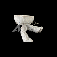 Service d'externalisation de traitement orthodontique pour aligneurs transparents sur mesure de précision, flux de travail numérique pour les laboratoires dentaires européens