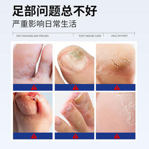 Pansement liquide médical OEM à base de plantes pour les plaies du pied, formule pour le soin des pieds, soulagement des rougeurs - Product Image 4