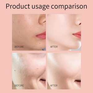 Maschera Viso Idratante Coreana Anti-Età con Collagene Idrolizzato e Vitamina C, per Tutti i Tipi di Pelle - Brand CLOVER <span class=keywords><strong>RENA</strong></span> - Product Image 5