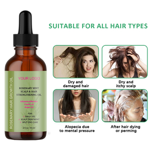 Commercio all'ingrosso rapido diradamento capelli raddrizzamento Anti perdita di capelli siero rosa maria ispessimento capelli crescere olio per gli uomini - Product Image 6