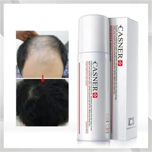 CASNER头发秃顶治疗喷雾脱发治疗帮助健康的头发生长血清为家庭男性和女性日常使用
