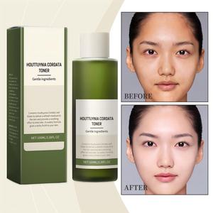 Tónico Facial de Houttuynia Cordata de Marca Blanca, 100 ml, Calmante, Alivia el Enrojecimiento, Controla la Grasa, Apto para Piel Sensible y Grasa, Uso Diario - Product Image 4