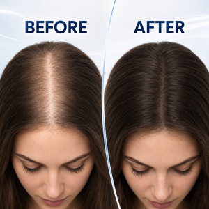 Sérum capillaire 2% de désoxyribose 20ml pour cheveux clairsemés, essence volumisante à la biotine et aux exosomes, solution de soin du cuir chevelu en roll-on - Product Image 5
