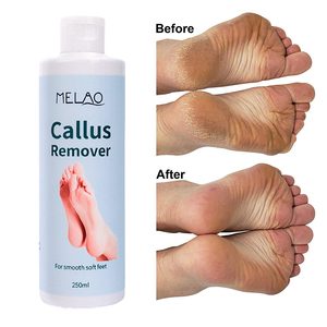 Exfoliante de Marca Privada, Gel Hidratante, Lima de Pies Colosal, Removedor de <span class=keywords><strong>Callos</strong></span>, <span class=keywords><strong>Crema</strong></span> Exfoliante <span class=keywords><strong>para</strong></span> Pies con Talones Agrietados - Product Image 4