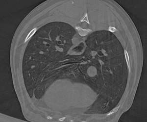 Dispositivo médico de alta tecnología escáner <span class=keywords><strong>CT</strong></span> veterinario precio bonito para uso veterinario MSLVCT03 - Product Image 5