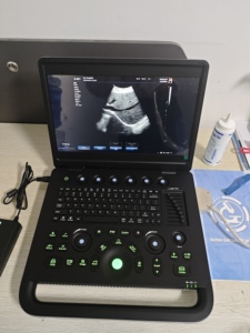 Escáner de ultrasonido a color 3D portátil uso en clínica de hospital OB GYN ultrasonido barato - Product Image 5