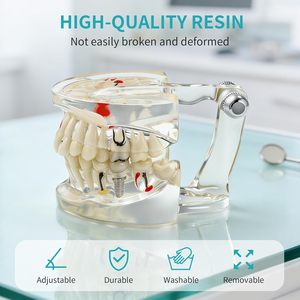 Modelo Dental Patológico Transparente con Dientes de Resina Removibles y Ángulo Ajustable para Enseñanza y Entrenamiento sobre Enfermedades - Product Image 4