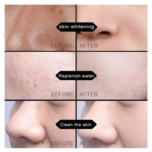Rutina de cuidado de la piel con control de aceite OEM/ODM para hombres, cuidado de la piel, exfoliante facial, humectantes, blanqueamiento, brillo, conjunto de cuidado de la piel para hombres - Product Image 4
