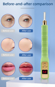 Pluma Eléctrica Automática de Doble Punta para <span class=keywords><strong>Labios</strong></span>, Ojos, Rostro y Piel, Inyección Automática para Uso Facial en Casa y en Salones de Belleza - Product Image 2
