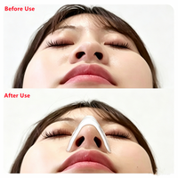 Attelle nasale écologique réutilisable et respirante en polymère rigide à haute élasticité pour la fixation – Outil de beauté en gros