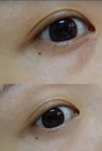 Chất Lượng Cao Hàn Quốc Mắt Làm Săn Chắc Nâng <span class=keywords><strong>Massage</strong></span> Ngay Lập Tức Mặt Mắt Cổ Hàm Nâng Máy Trên Bán - Product Image 5