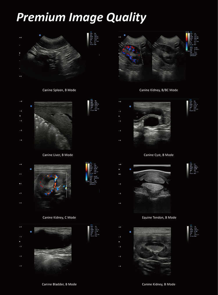 Fábrica Chison Ebit 50 Equipos de Ultrasonido Médico 3D 4D Sistema de Doppler de Color con Sonda Convexa