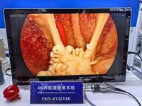 Système de caméra endoscopique portable 4K UHD tout-en-un pour chirurgie électrique, ORL, hystéroscopie, urologie, laparoscopie, tour laparoscopique IKEDA CE