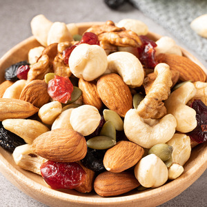 Hàng Mới Về 7 Loại Hạt Hỗn Hợp Đóng Hộp - Hạt Điều Trung Quốc, Hạt Điều, Hạt Dẻ, Đồ Ăn Vặt, Sản Phẩm Bán Chạy, Đồ Ăn Vặt Ngoại Lai - Product Image 6