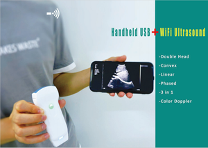 3-In-1 Convexe Lineaire Cardiale Dubbele Kop Draadloze Kleur Doppler Ultrasone Scanner Veterinaire Bewakingsapparaat - Product Image 2