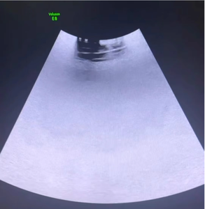 OEM Quality Ultrasound <b>Probe</b> Repair Electronic <b>Power</b> Save up to 70%-We Charge 30% of Manufacturer's Price - Product Image 6