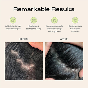 แปรงนวดหนังศีรษะและเส้นผม สำหรับสระผมแบบเปียกและแห้ง ใช้สำหรับนวดสปาหนังศีรษะ ขัดทำความสะอาดเส้น<span class=keywords><strong>ผม</strong></span> และหวีสระผมเพื่อการทำความสะอาดอย่างล้ำลึก - Product Image 3