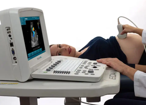 Appareil d'échographie Doppler couleur portable Edan U50, instruments d'échographie médicale pour le diagnostic clinique humain - Product Image 4