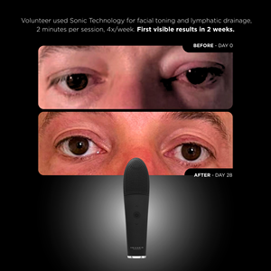 Appareil facial triple action UNICTHERMO SONIC 2.0-UNICBLACK : Nettoie, tonifie et rajeunit le visage, le cou et le décolleté, usage domestique - Product Image 4