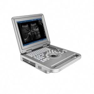 Beste kwaliteit zwart-wit draagbare echografiemachine, ultrasonische diagnostische systeem voor mensen, MSLPU11 apparatuur - Product Image 2