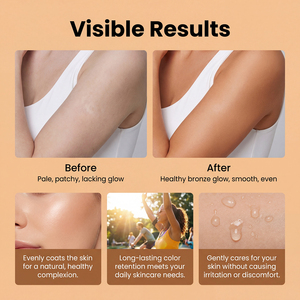 <span class=keywords><strong>Protector</strong></span> <span class=keywords><strong>Solar</strong></span> y Acelerador de Bronceado de Marca Privada de 100 ml, Spray Bronceador Impermeable para Exteriores para el Cuerpo - Product Image 2