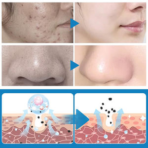 Pastiglie di acido Kojic curcuma naturale etichetta privata che illuminano la pelle curcuma acido kojico pulizia Anti Acne per il viso - Product Image 5