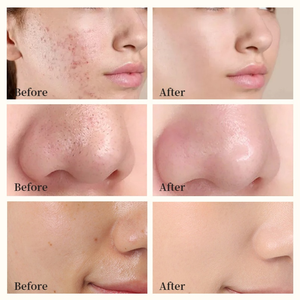 Mascarilla Facial de Arcilla con Vitamina C Orgánica y Cúrcuma de Marca Privada, Mascarilla Facial Vegana Natural para el Cuidado de la Piel, Mascarilla de Arcilla para Hombre de Marca Privada - Product Image 4