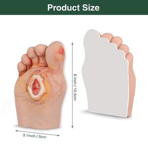 Mannequin <span class=keywords><strong>de</strong></span> formation médicale pour pied diabétique, 5 pièces, taille humaine, en PVC, origine Henan, marque Yulin, niveaux 1-5, pour écoles - Product Image 2