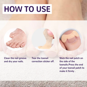 Đàn hồi nước kích hoạt Bopp cao su duy nhất hai mặt móng chân <span class=keywords><strong>Correction</strong></span> <span class=keywords><strong>tape</strong></span> 50 cái mọc ngược móng chân chỉnh sửa công cụ - Product Image 3