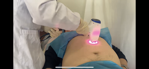 Superlaser Portable Dermatology Commercial Diode <span class=keywords><strong>Laser</strong></span> 808nm Appareil de beauté pour l'épilation au <span class=keywords><strong>laser</strong></span> de la peau Fabriqué en Chine - Product Image 2