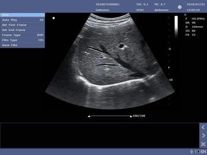 Mesin Ultrasound 2D <span class=keywords><strong>Doppler</strong></span> warna JZ-CUP60 JINZHONG, pemindai Vet elasografi Waktu Nyata layar 15 inci penggunaan hewan biaya rendah CE - Product Image 3