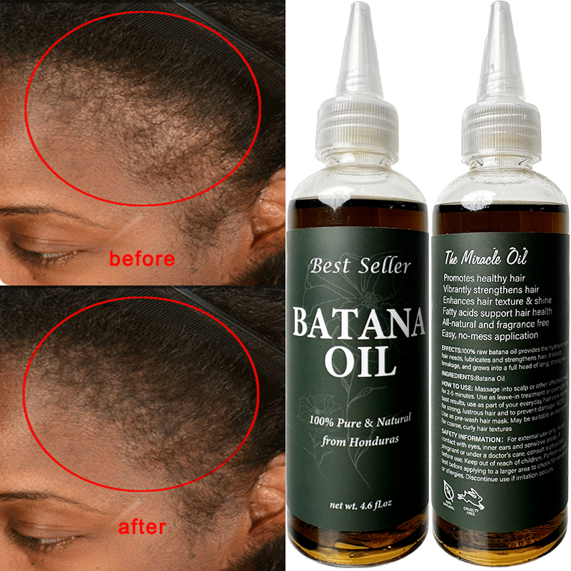 Batana Black Women's Hair Growth Oil Veganic Natural Keratin Treatment with Rosemary Essential Oils Fast Hair for Serum