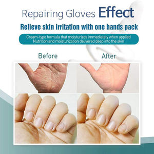 Gants exfoliants blanchissants sans parfum DAAO avec masque pour les ongles pour les mains rugueuses - Product Image 4