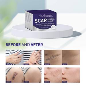 Crema trasparente Sakura Melasma Made in Korea per la rimozione della cicatrice Sakura - Product Image 4